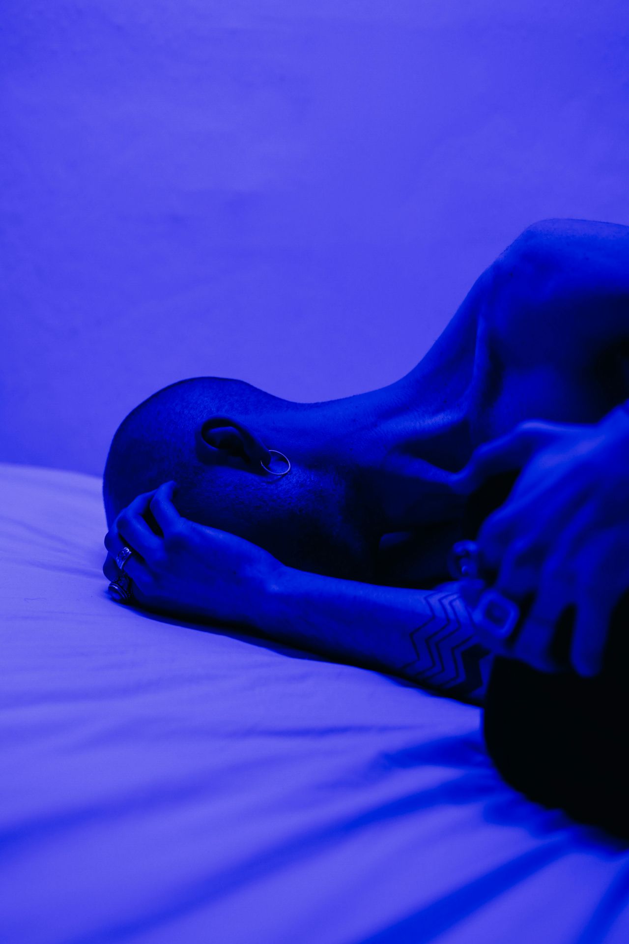 blue tint image of stressed bald person laying on a bed covering their face with hand; anxiety is common and treatable. Signs and symptoms of anxiety